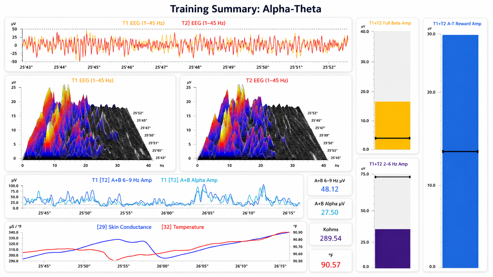 End of A-T training session showing crossover, with 6-9 Hz activity at 48.12 microvolts exceeding 8-12 Hz alpha at 27.50 microvolts