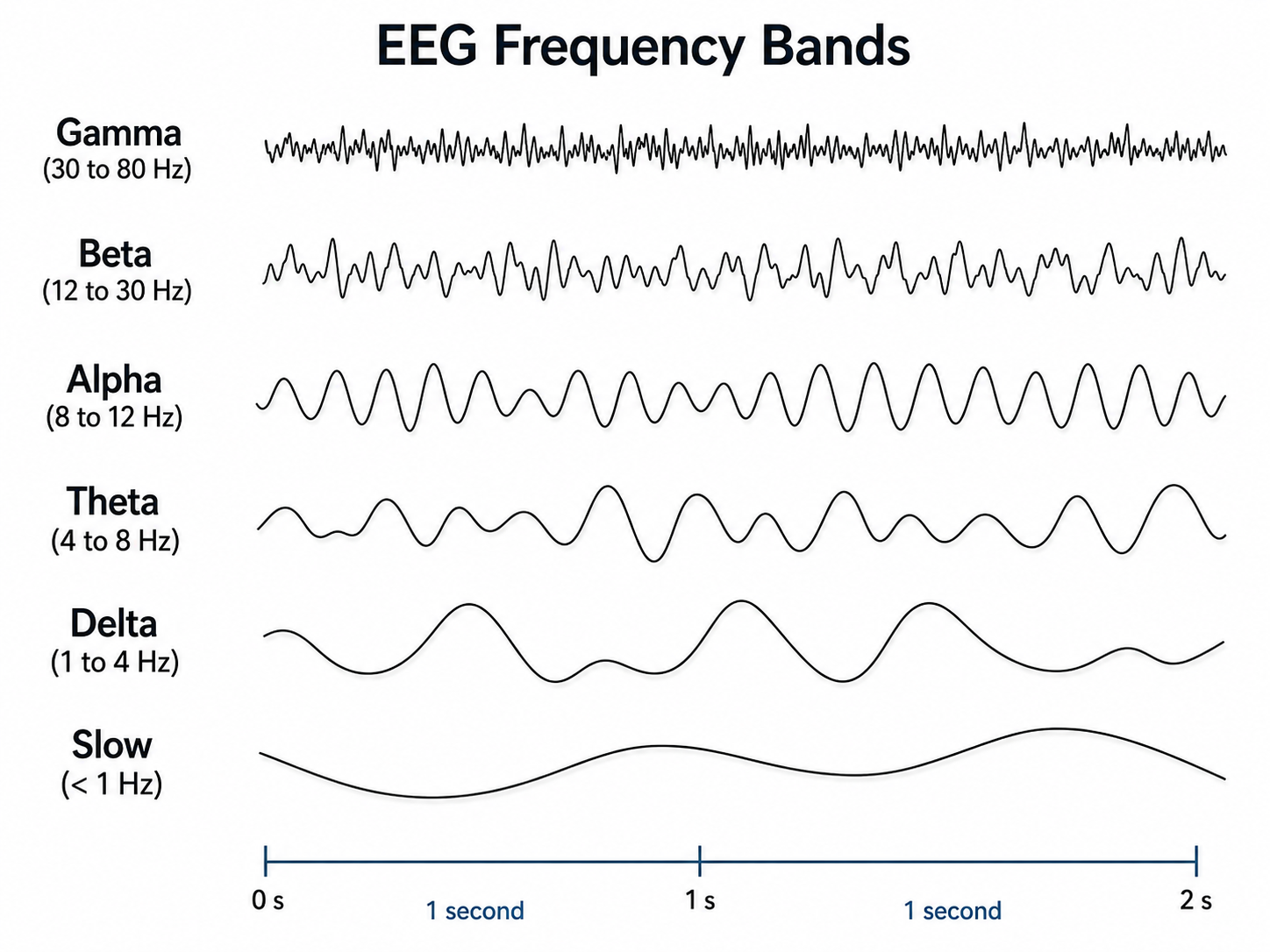 EEG frequency bands