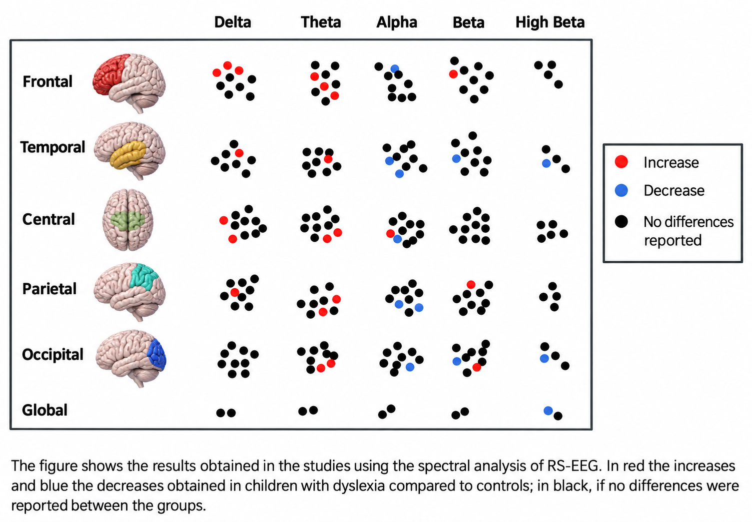 Grid of dots summarizing resting-state EEG spectral findings in dyslexia by region and frequency band; red dots mark increases, blue dots decreases, and black dots no difference