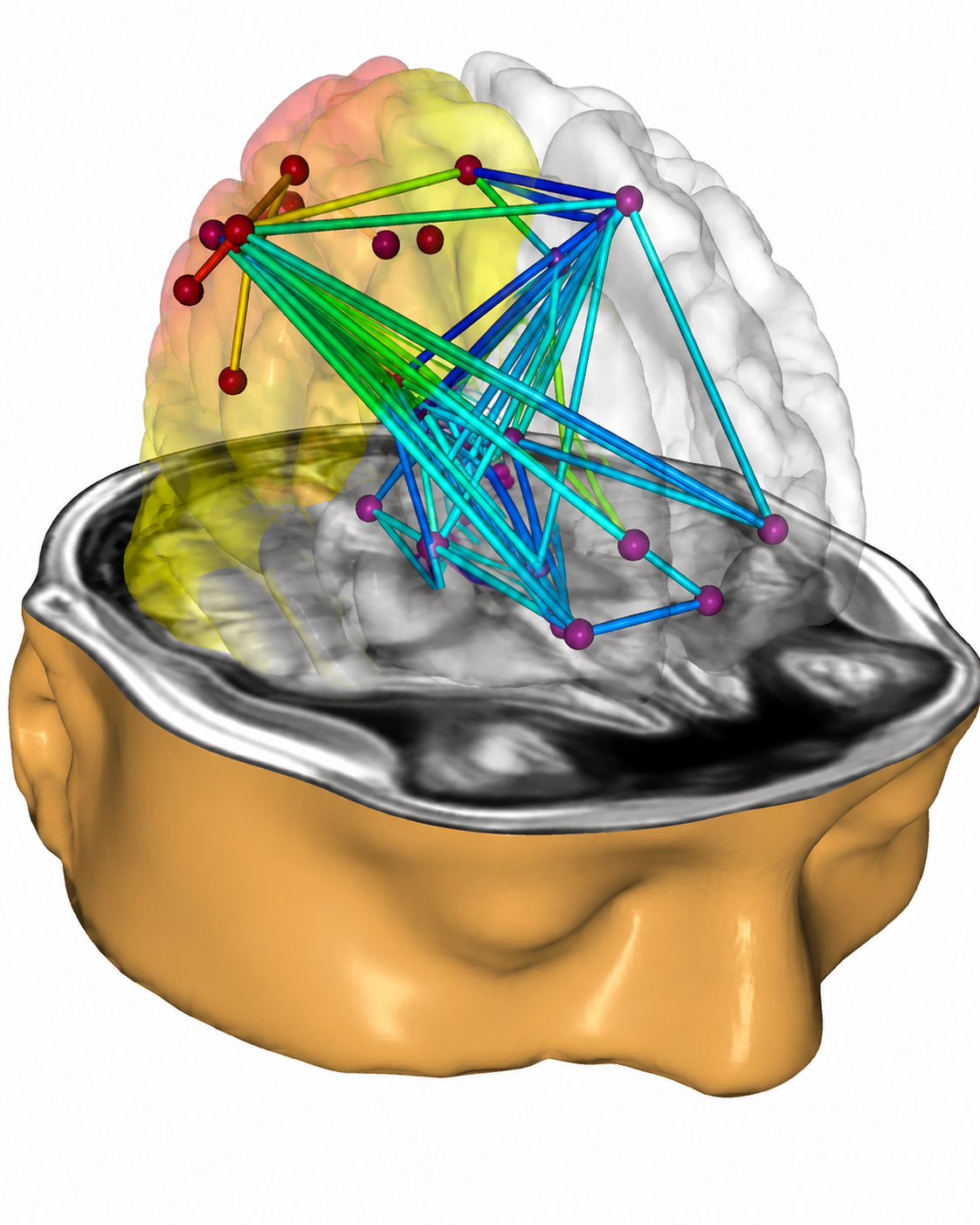 NeuroNavigator swLORETA visualization of the default mode network