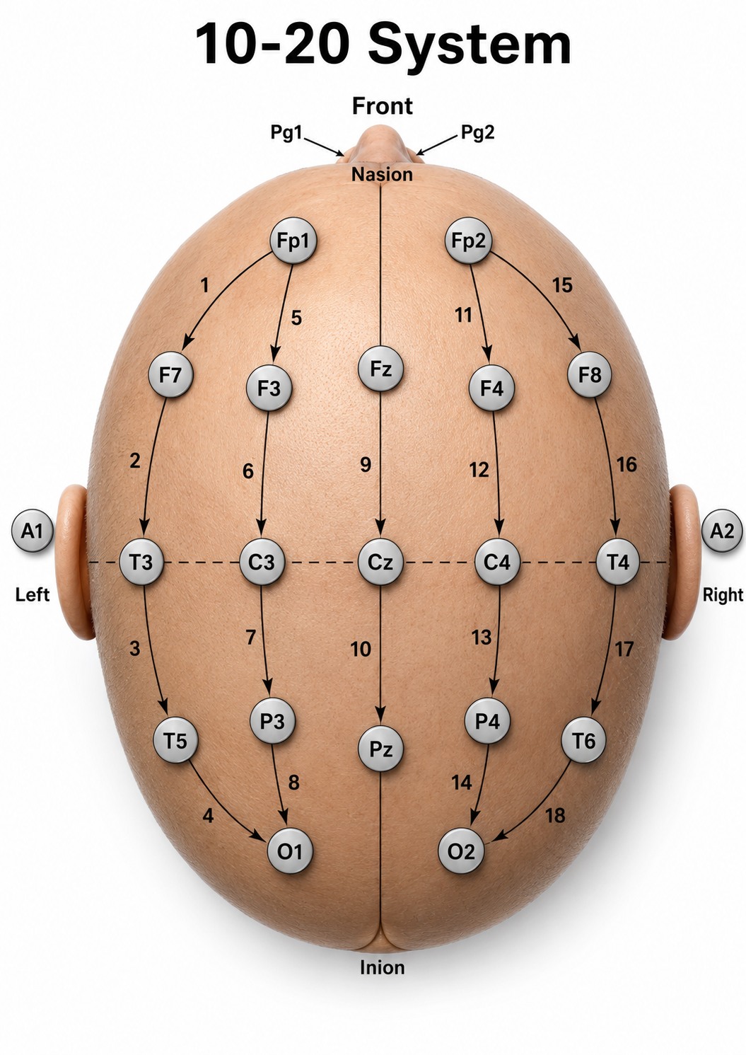 Head diagram showing the electrode chains of the longitudinal bipolar double-banana montage