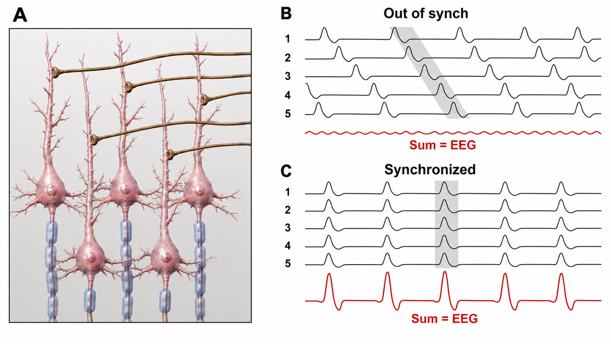 Diagram contrasting asynchronous and synchronized postsynaptic potentials in five pyramidal neurons, with the summed EEG shown beneath each: near-flat when out of synchrony, large-amplitude when synchronized