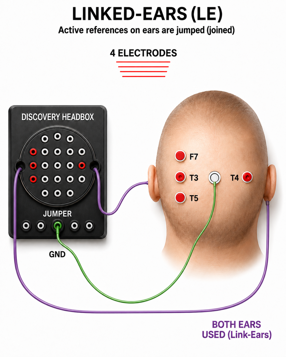 Linked ears reference diagram