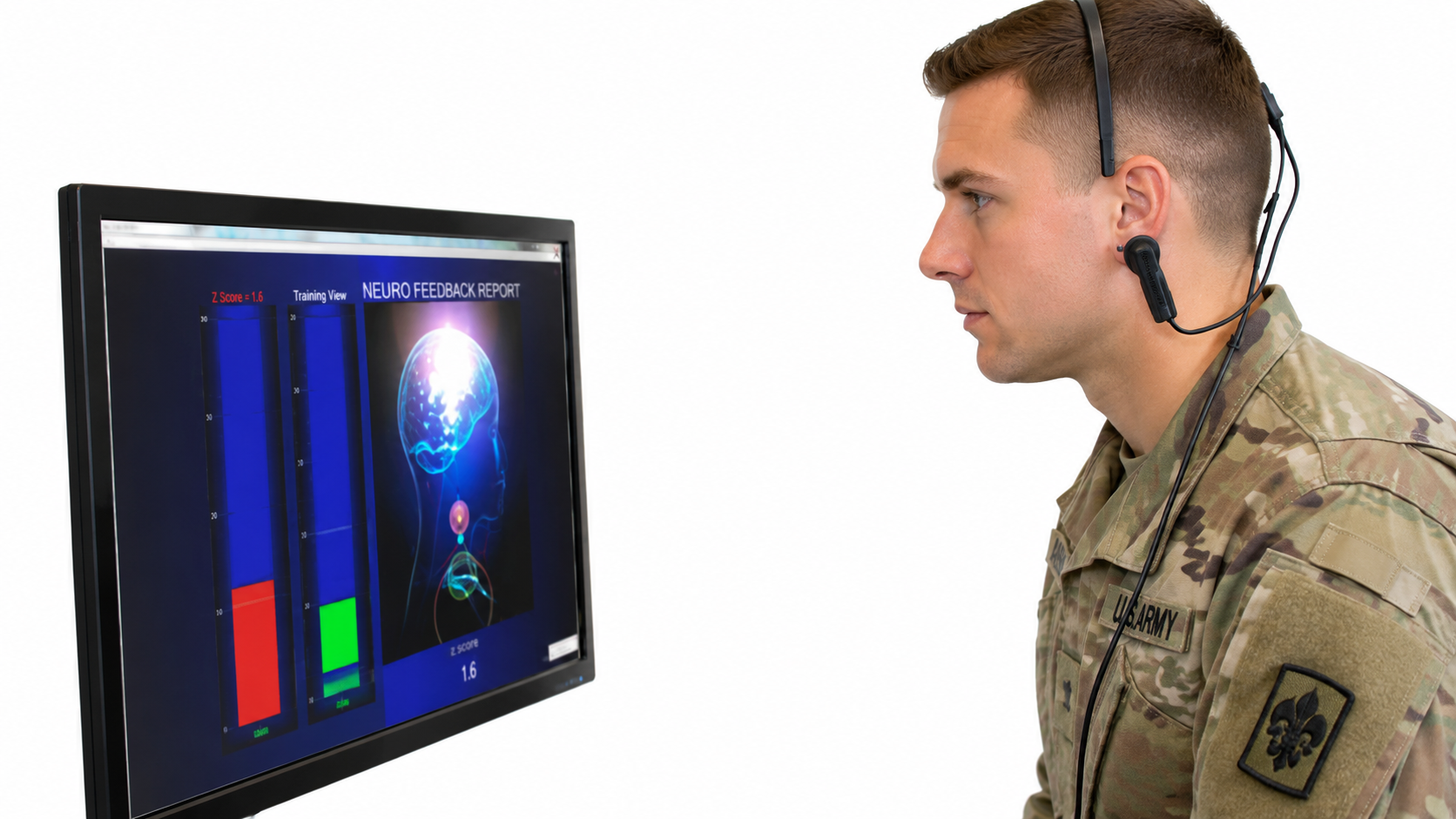 MindMedia neurofeedback equipment display showing brainwave monitoring