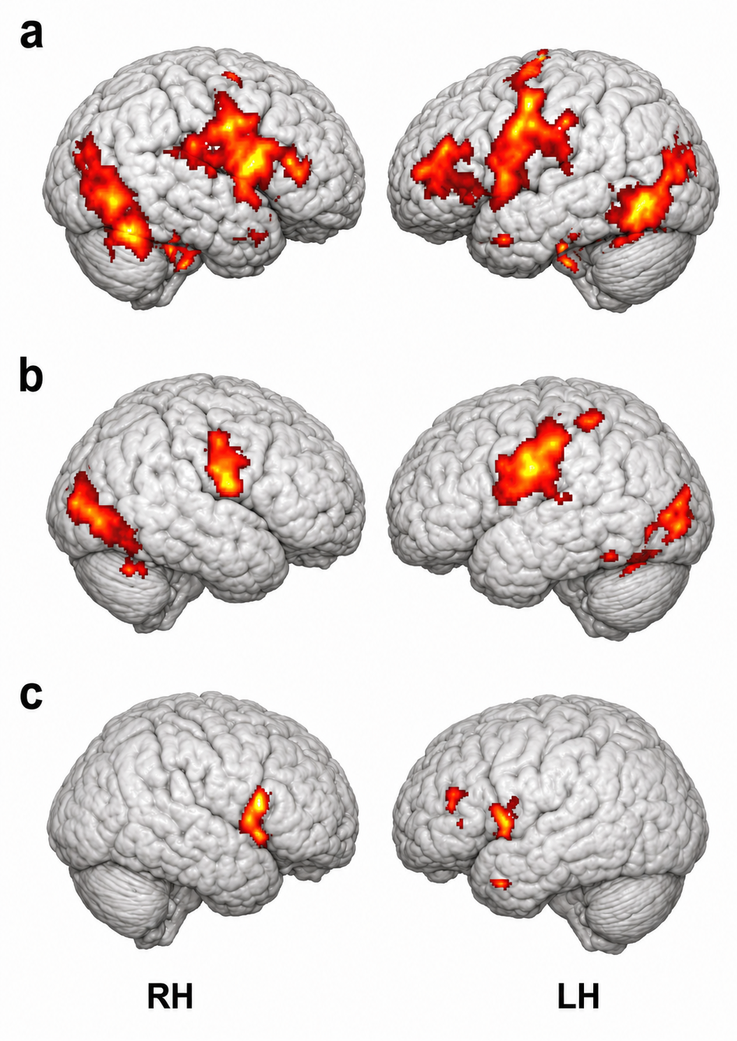 Brain diagram marking the additional regions with mirror properties reported by Molenberghs and colleagues, including cerebellum, limbic structures, and primary visual cortex.