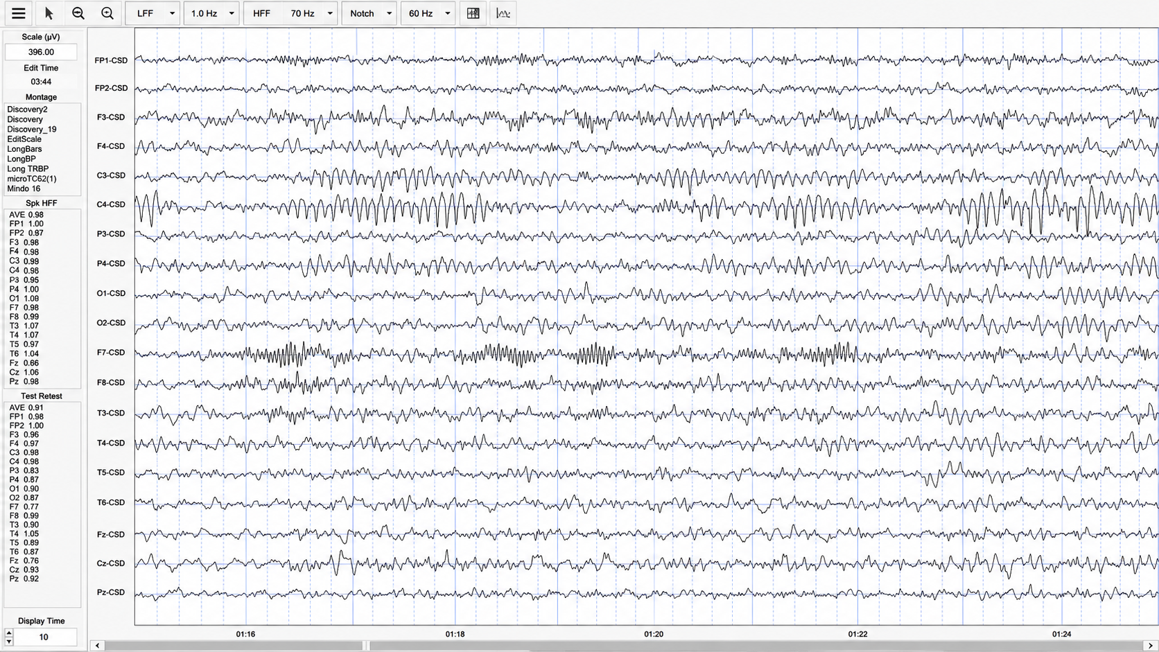 Nineteen-channel EEG display with per-channel reliability coefficients and filter settings shown alongside the tracings