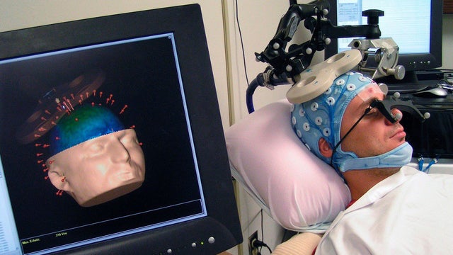 Repetitive transcranial magnetic stimulation device