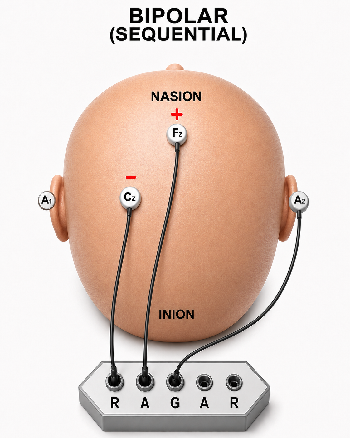 Diagram illustrating a sequential montage electrode placement