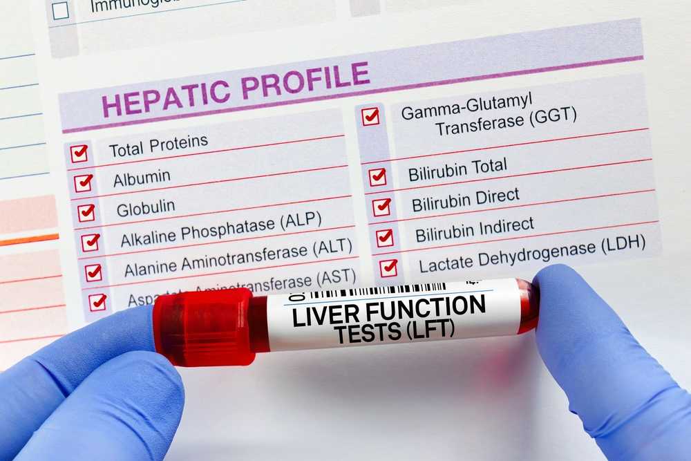Blood sample tubes used in functional medicine testing