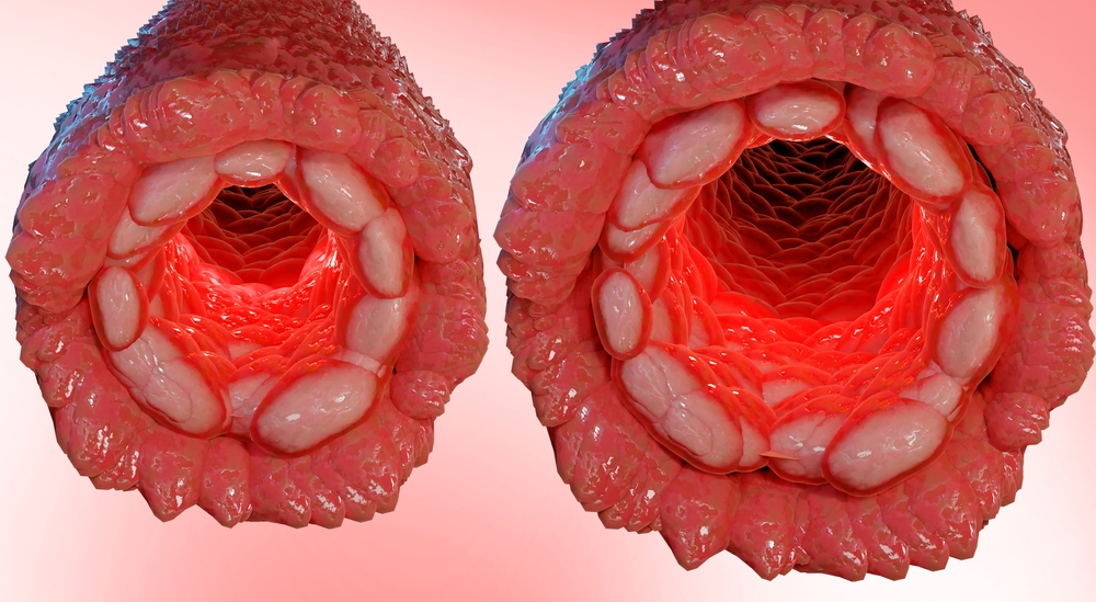 Cross-section of a blood vessel showing blood flow through the dilated vessel wall