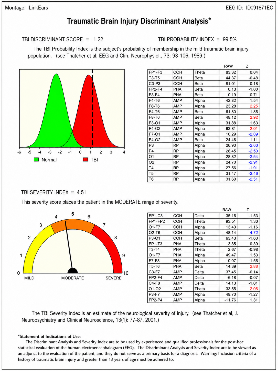 TBI discriminant analysis from NeuroGuide