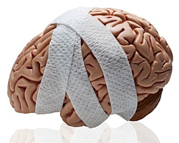 Traumatic brain injury illustration