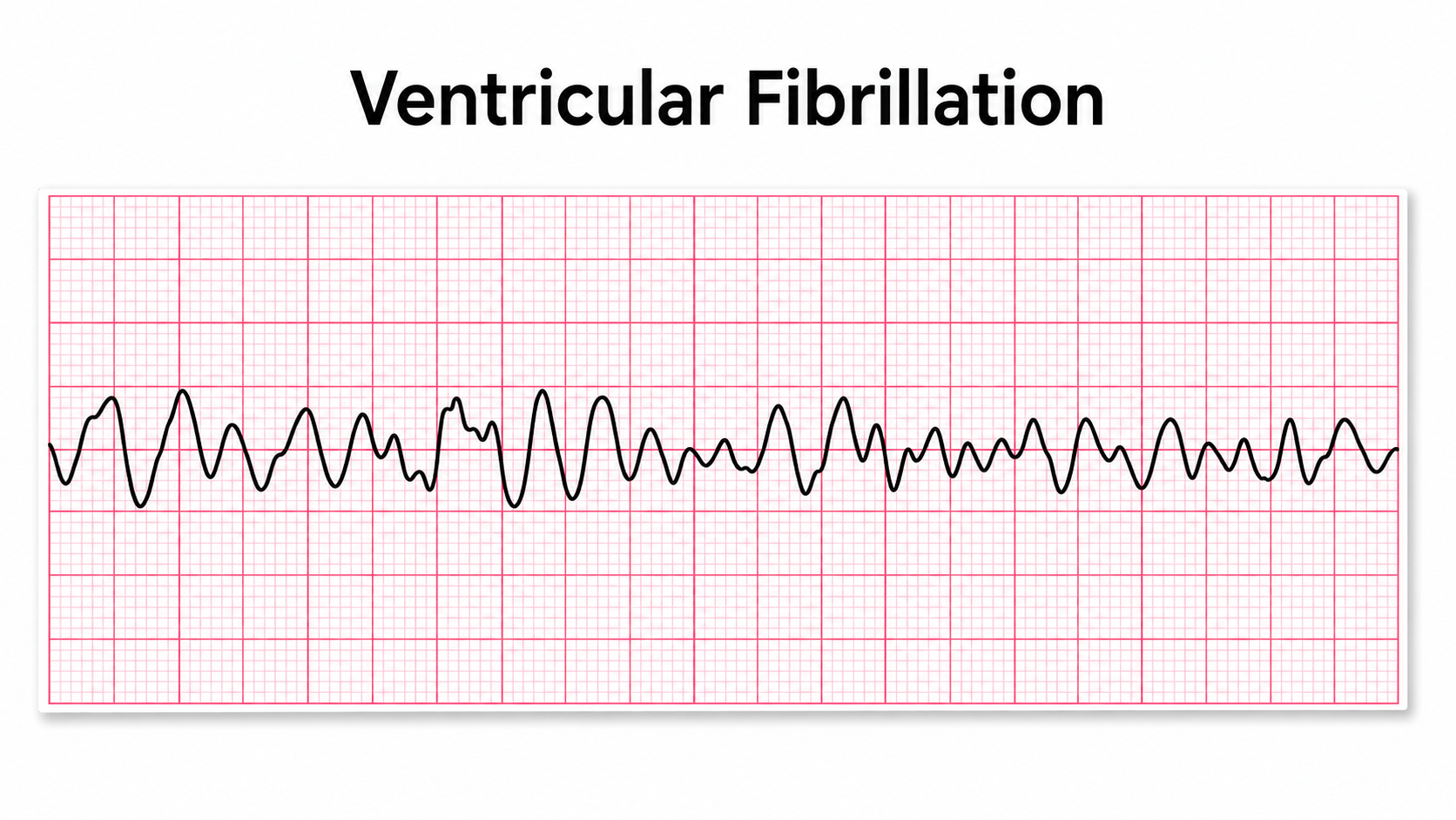 Electrical shock danger levels