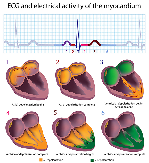 ECG stages