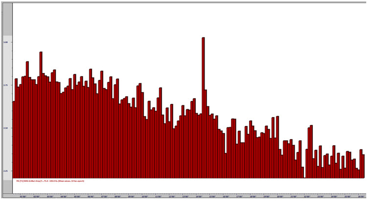 Graph showing EMG artifact amplitude decreasing across the neurofeedback session over approximately 26 minutes