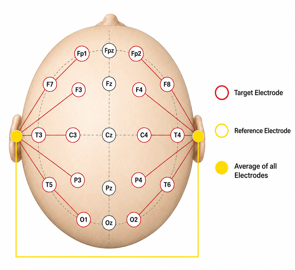 Average reference montage diagram