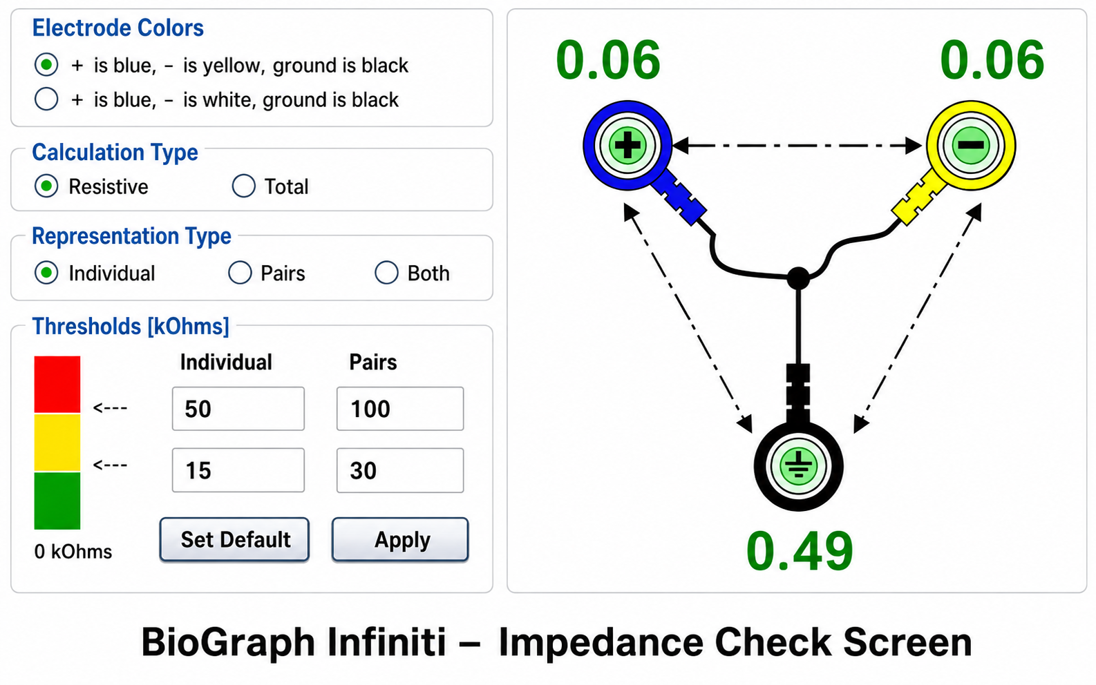 Software impedance test display