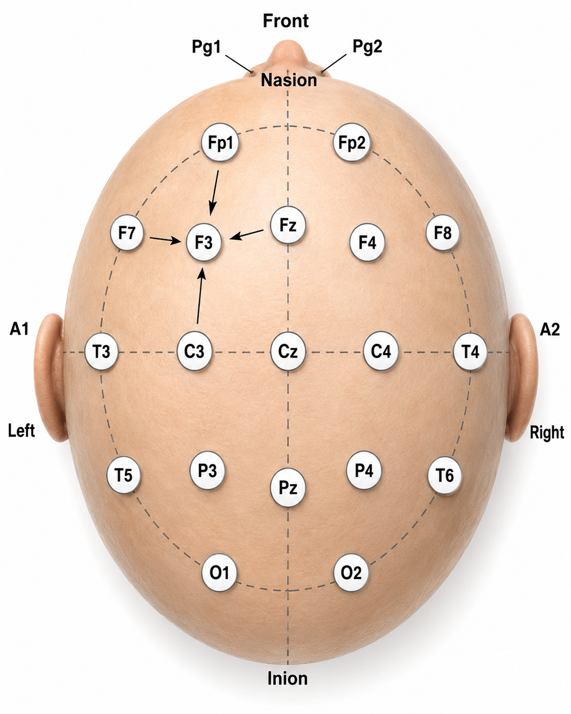 Intermediate electrode sites