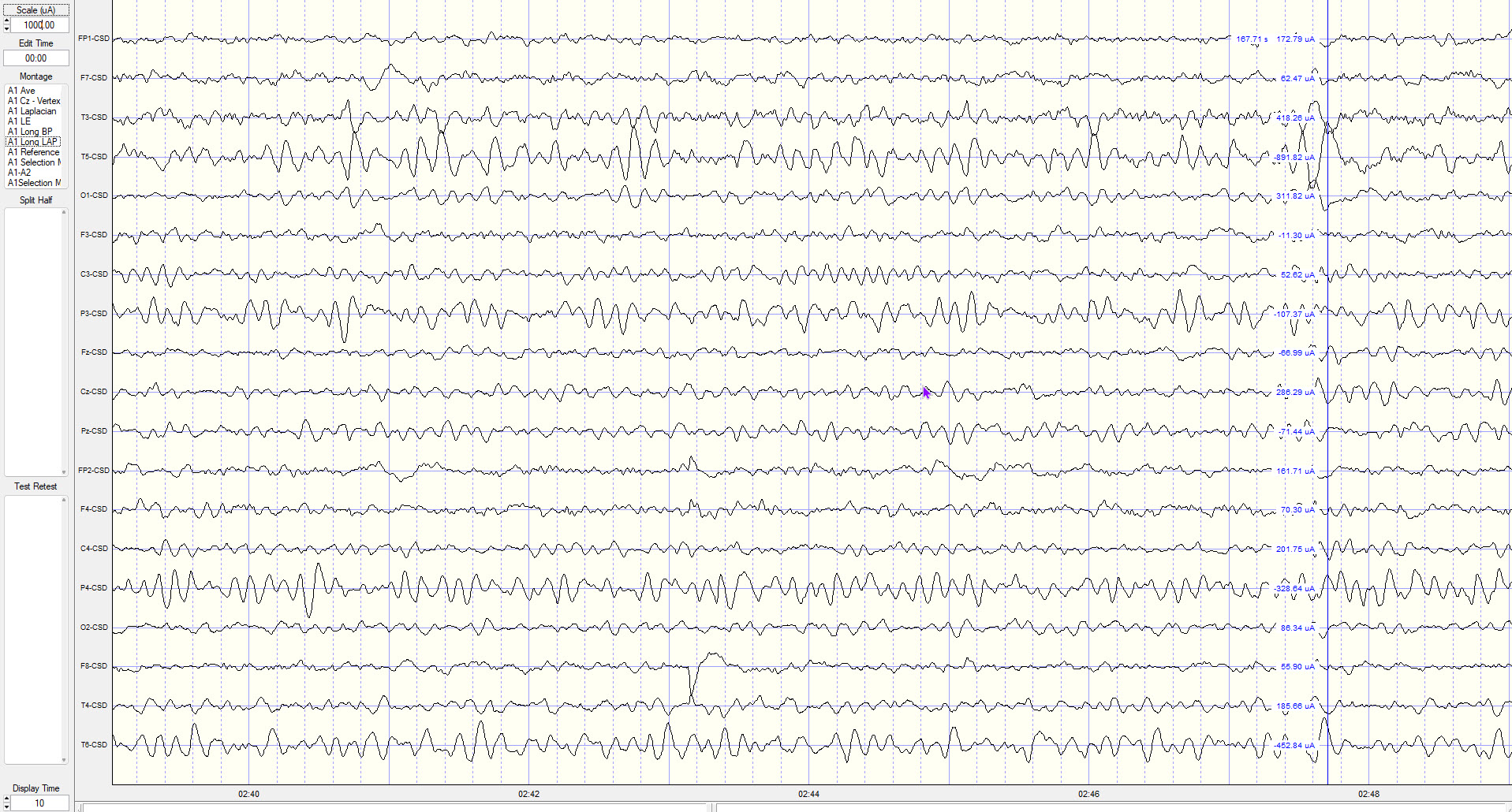 Longitudinal Laplacian chain view