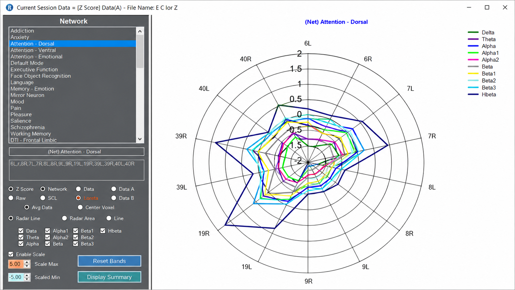 LORETA progress report brain maps