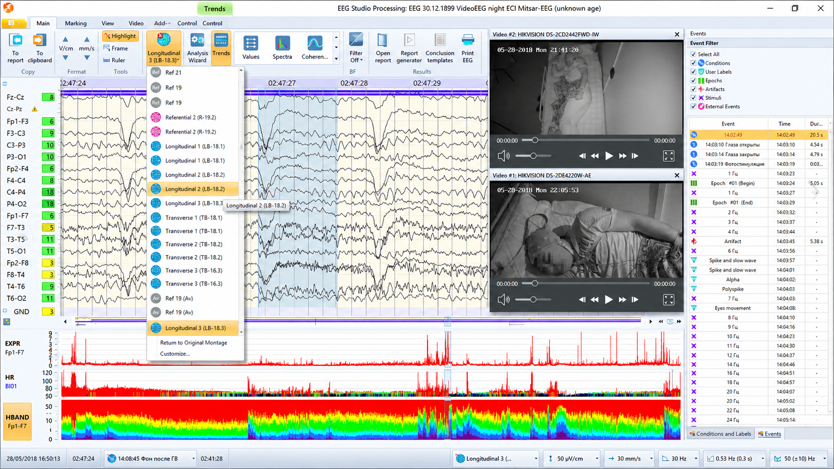 Mitsar EEG assessment system display showing ongoing monitoring capabilities