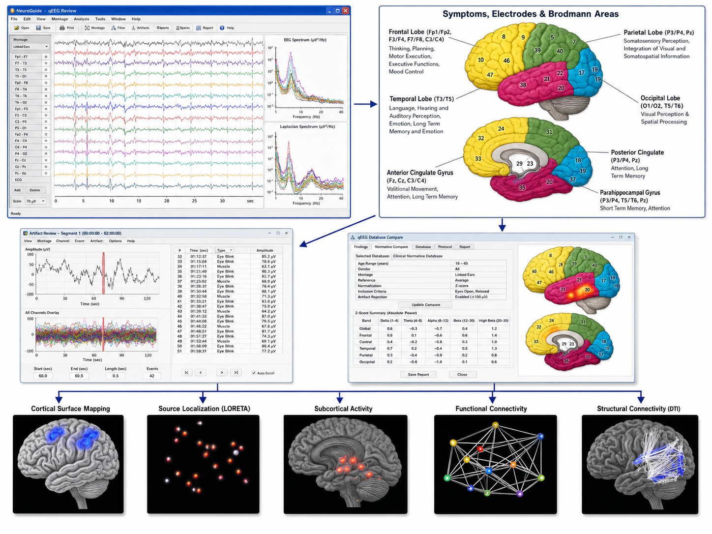 NeuroGuide qEEG workflow: raw EEG review with power spectra, a symptom-electrode-Brodmann area map, artifact review, normative database comparison with a z-score summary table, and cortical surface mapping, LORETA source localization, subcortical, functional, and structural connectivity outputs