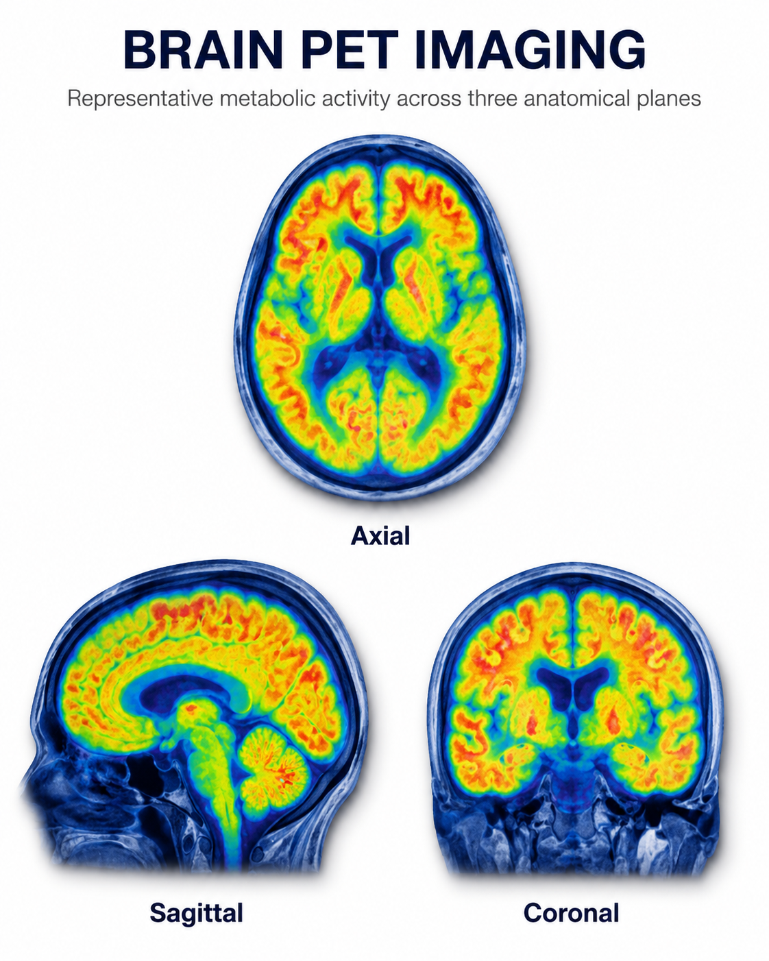 PET brain images