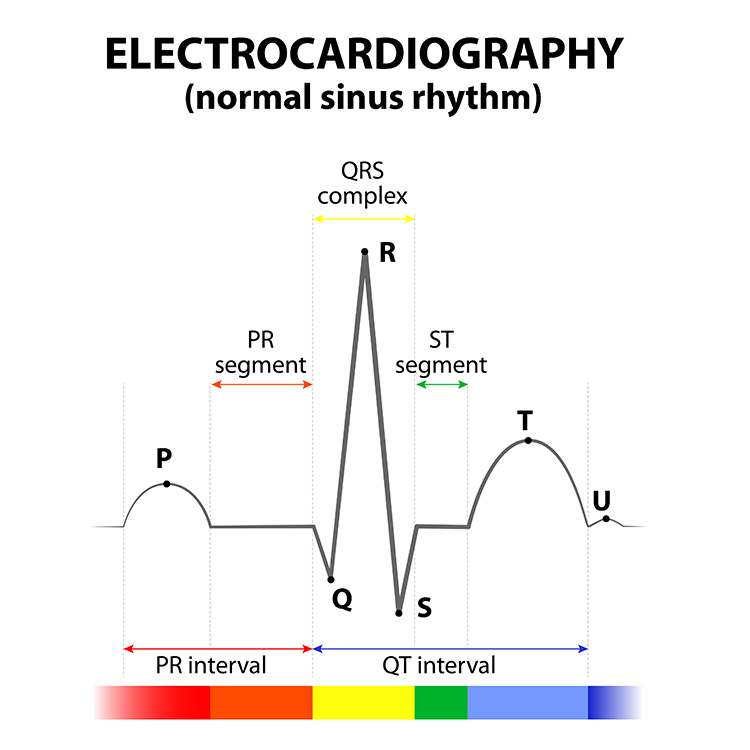 QT interval diagram