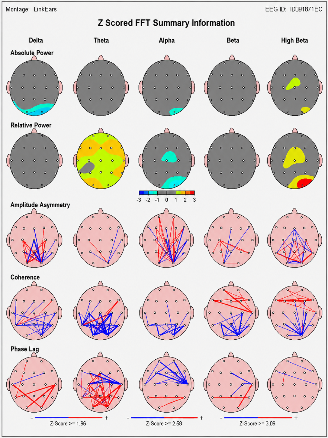 Z-scored FFT summary page showing head maps for absolute power, relative power, amplitude asymmetry, coherence, and phase lag across delta, theta, alpha, beta, and high beta