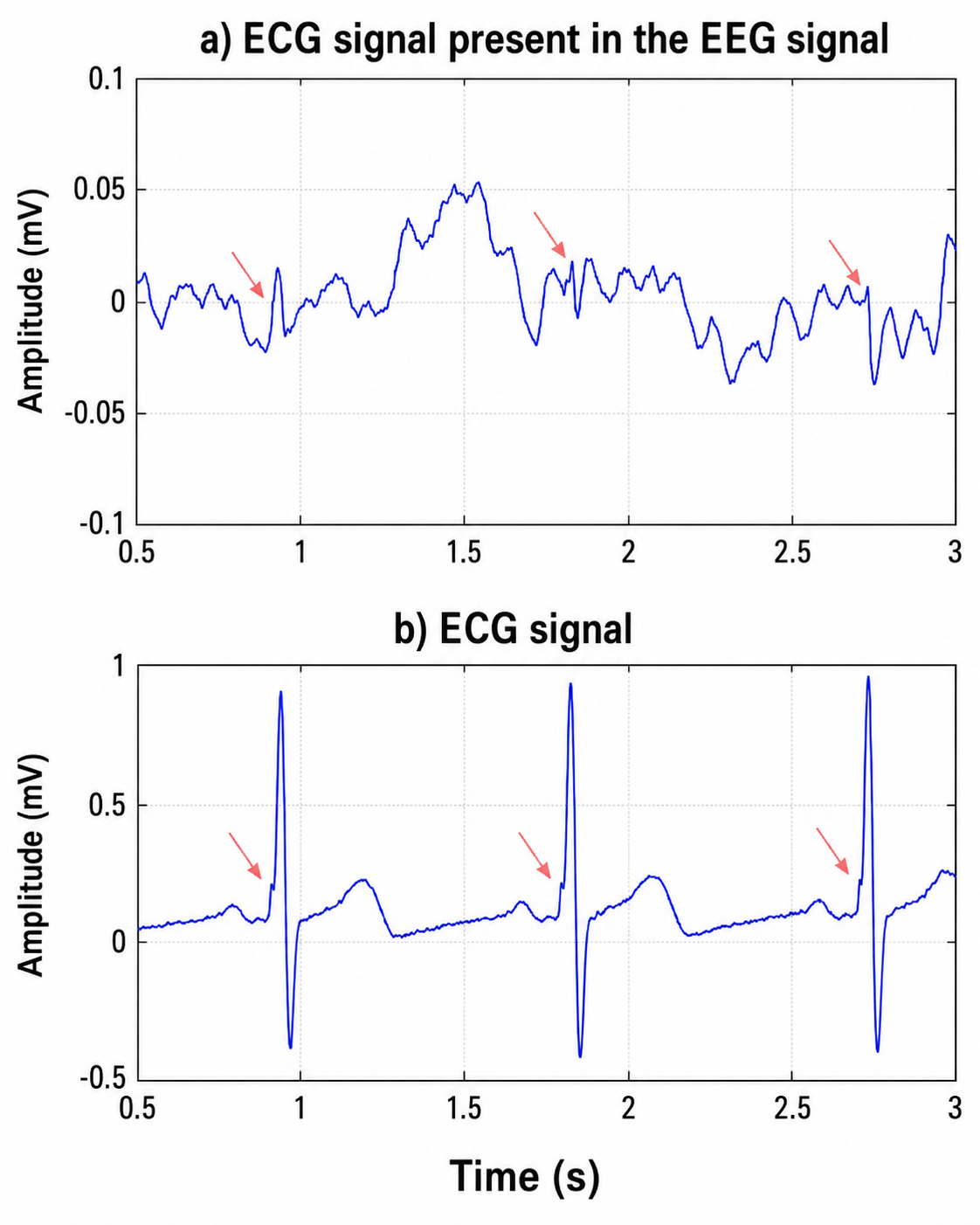 ECG artifact in EEG record