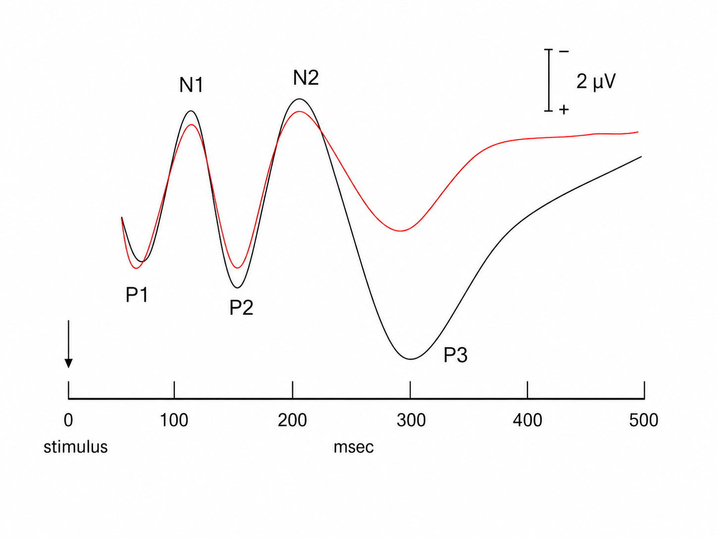 Example of an evoked potential waveform