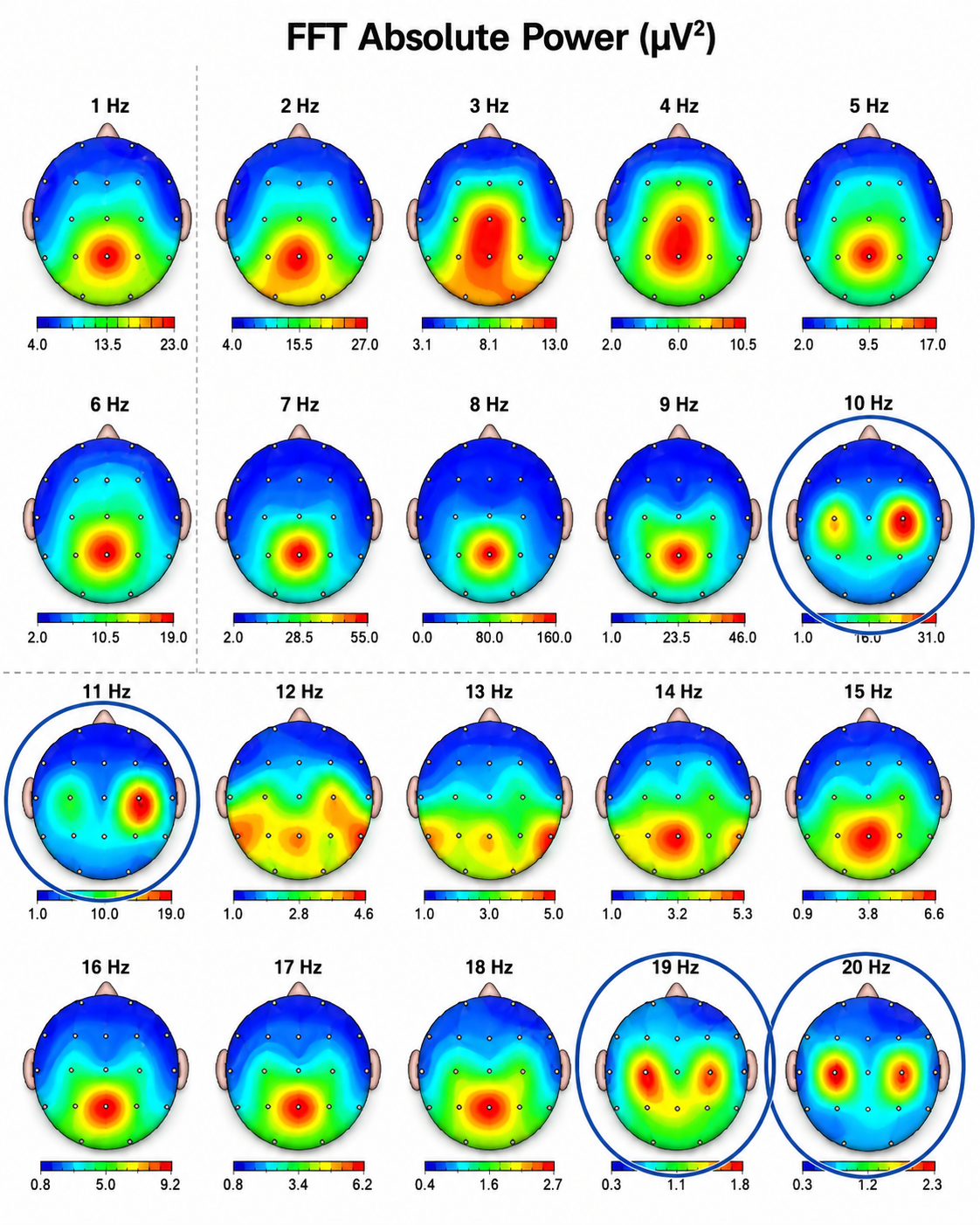 Grid of topographic head maps from 1 to 20 Hz showing power distribution for each single-hertz bin