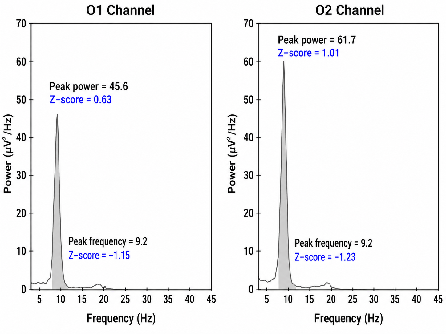 iSynchBrain single-hertz spectral comparison at O1 and O2 with z-scores for peak frequency and power