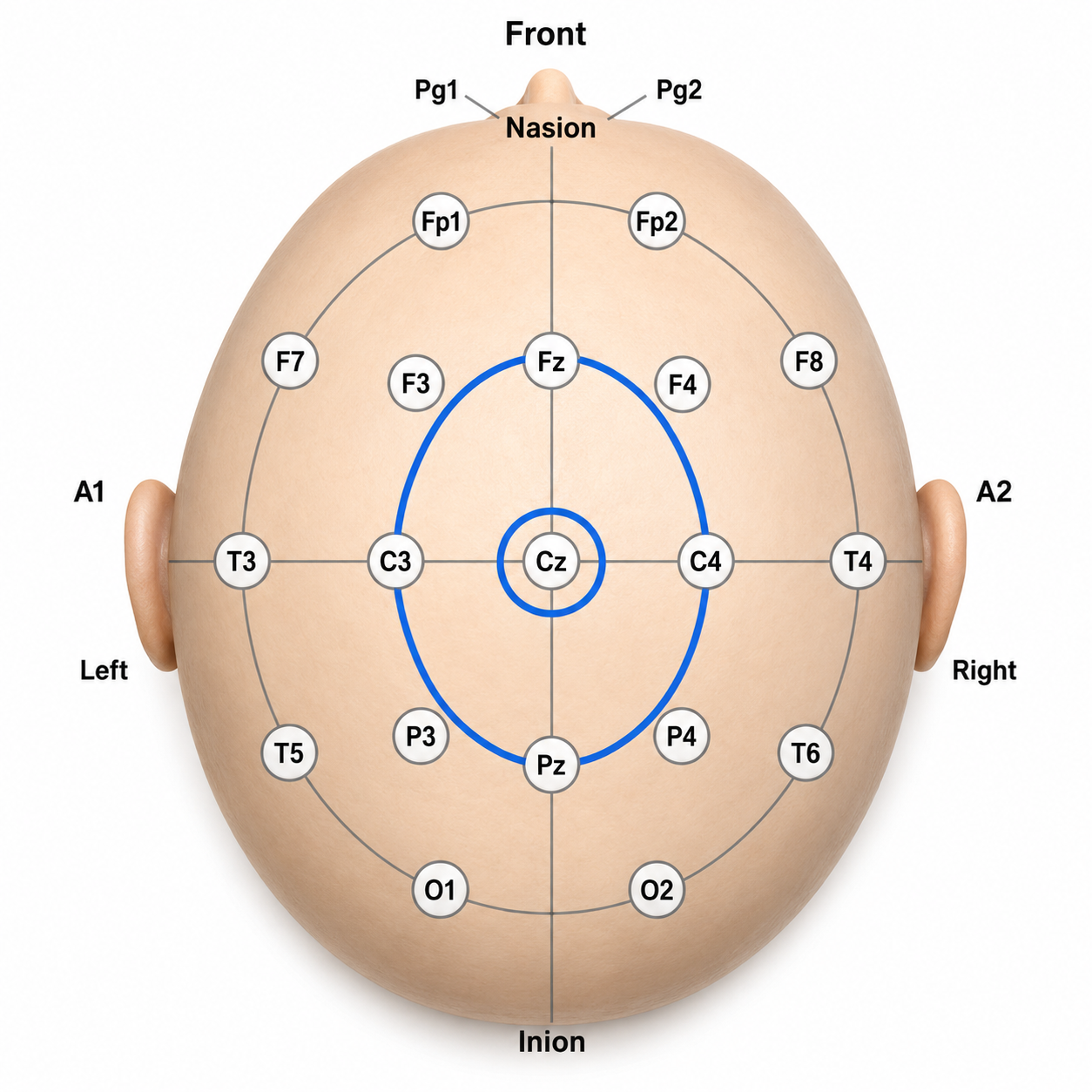 Laplacian montage diagram