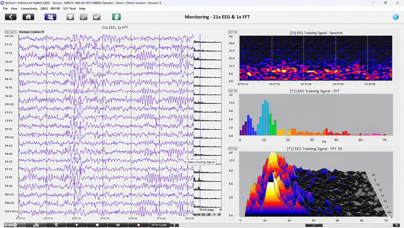 Raw tracings and multiple spectral displays