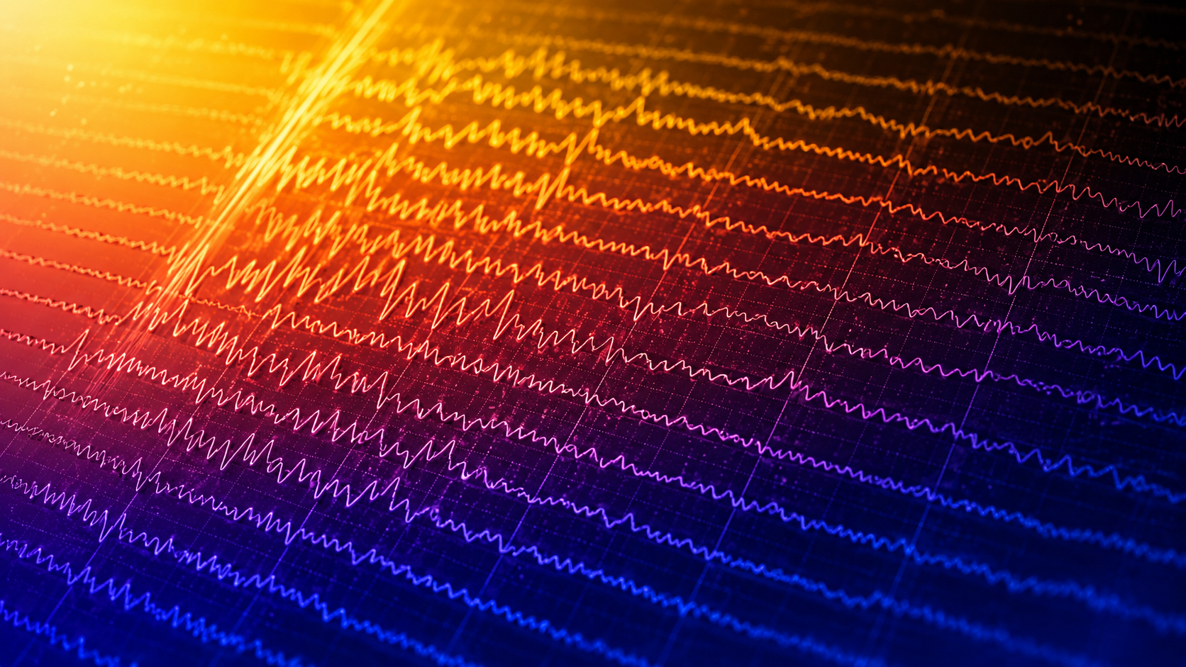 Epileptiform activity illustration